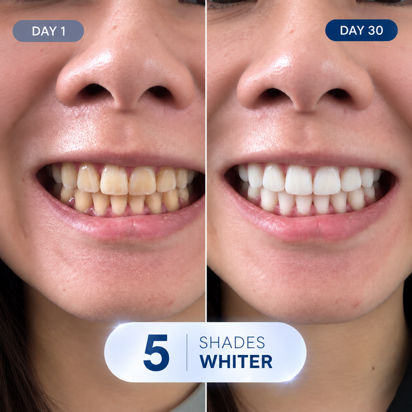 Transformed My Smile!
