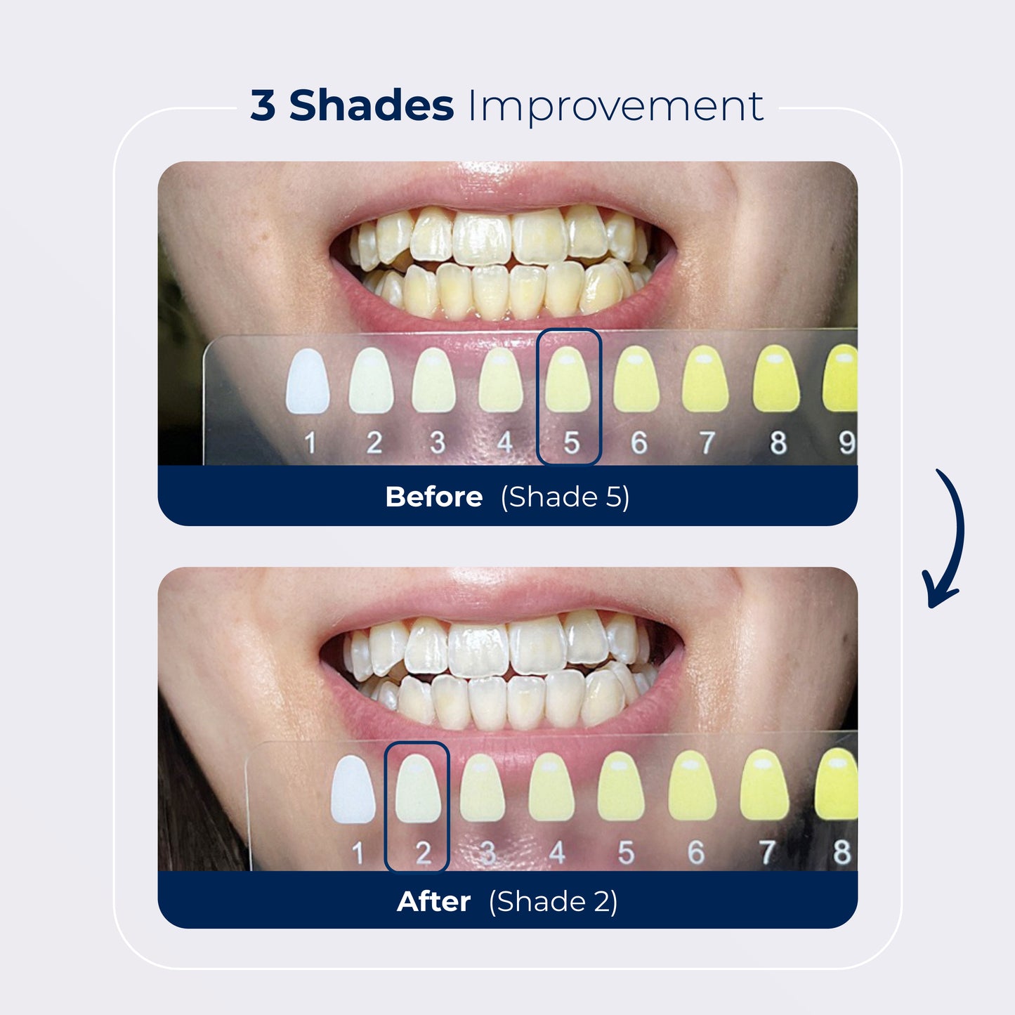 Ultimate Whitening Bundle