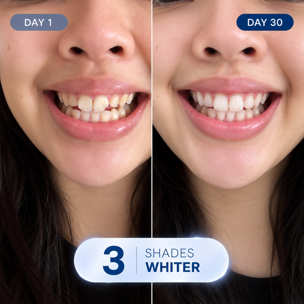 My Smile Makeover!