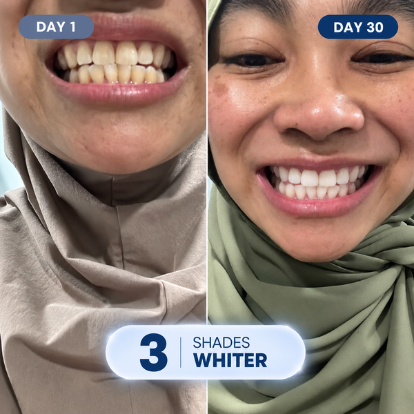 Got My Smile Back!